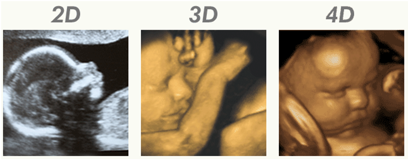8k ultrasound image vs 3d 4d